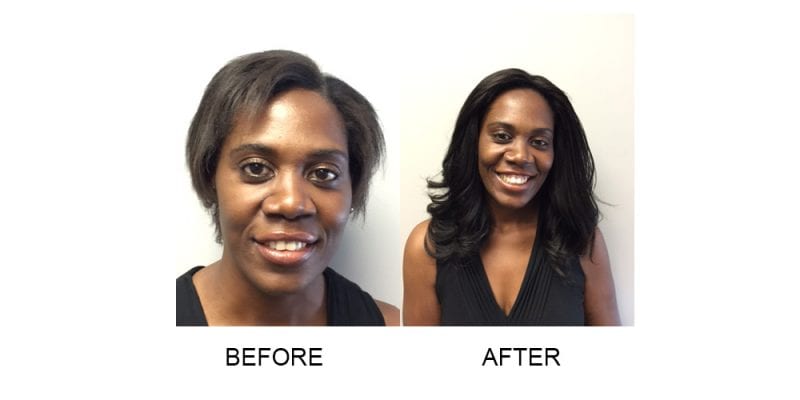 Before and After with Invisablend Hair Treatment