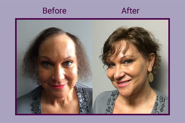 Before and After with Invisablend