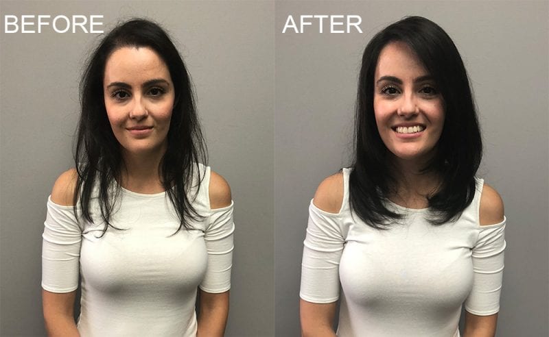 Before and After with Invisablend