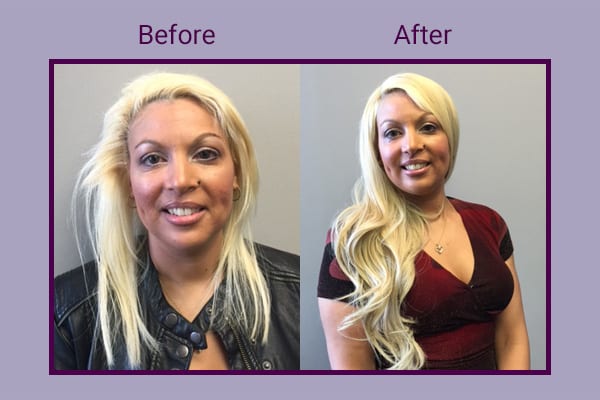 Before and After with Invisablend